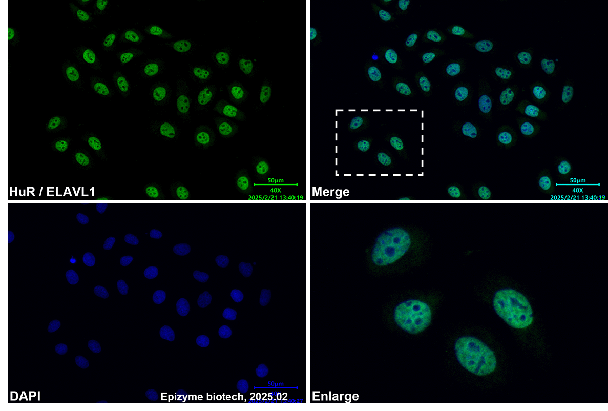 Anti-HuR/ELAVL1 Mouse mAb [85C77F16]