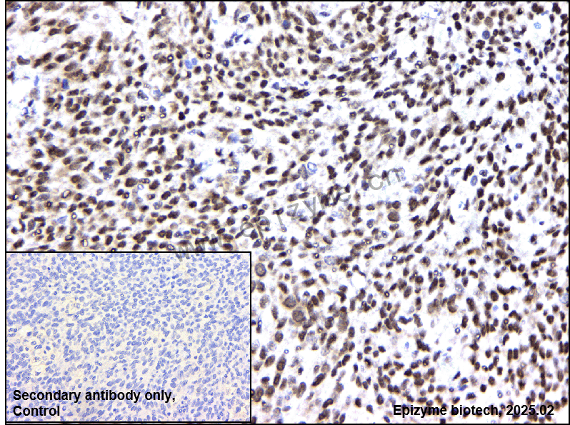 Anti-HuR/ELAVL1 Mouse mAb [85C77F16]