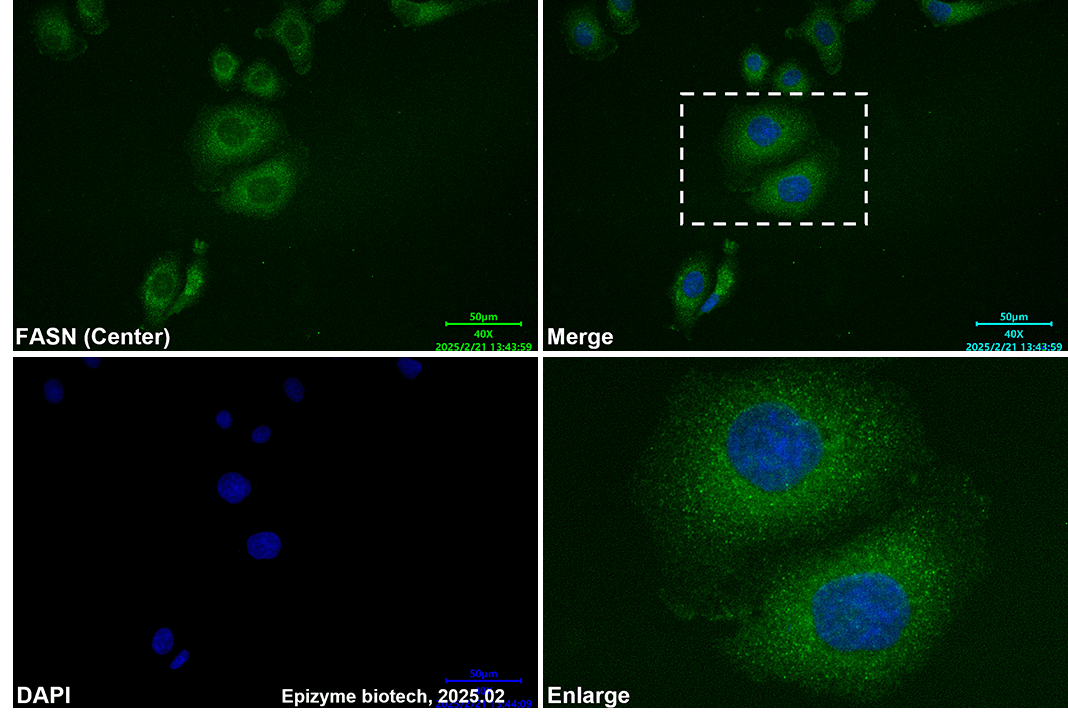 Anti-Fatty Acid Synthase Mouse mAb [39M66G65]
