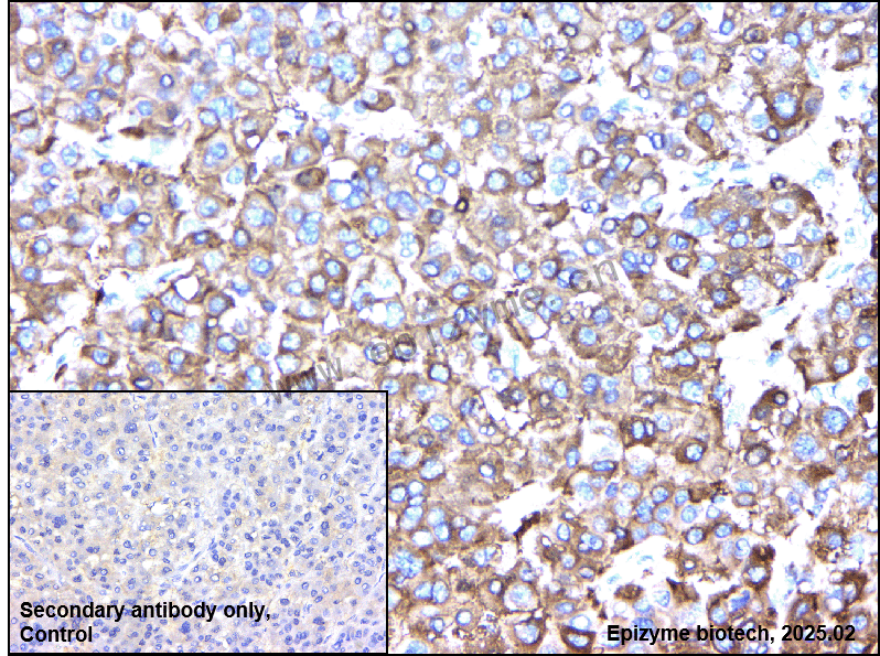 Anti-Fatty Acid Synthase Mouse mAb [39M66G65]