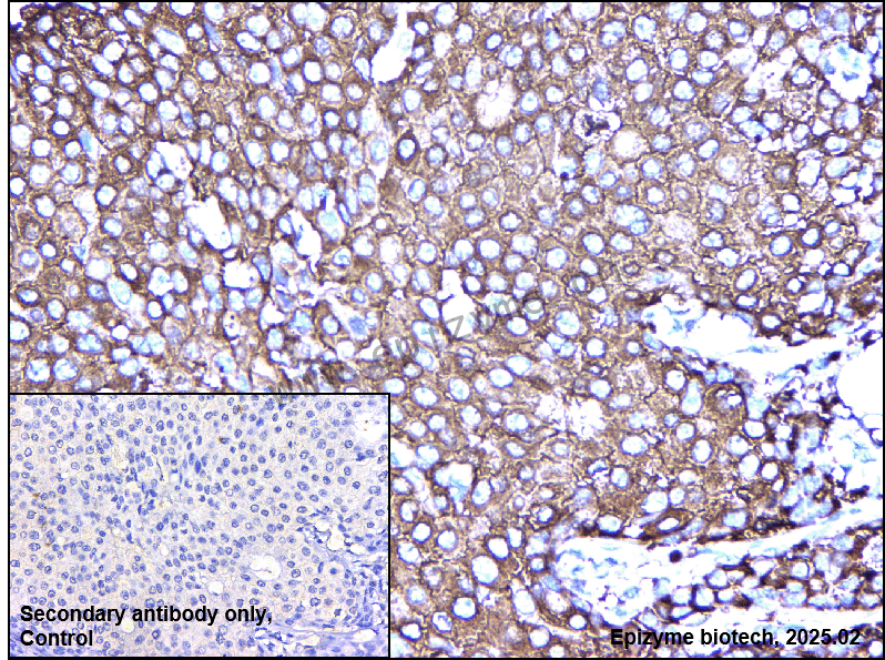 Anti-Fatty Acid Synthase Mouse mAb [39M66G65]