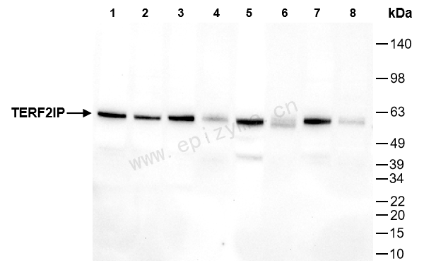 Anti-RAP1/TERF2IP Mouse mAb [87C88P28]