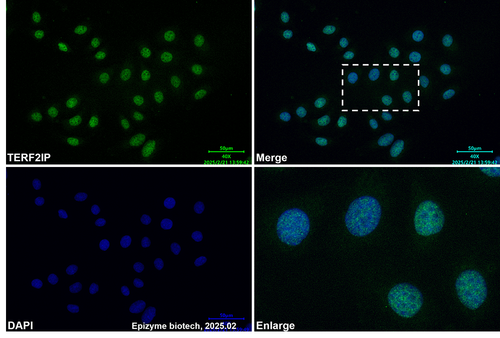 Anti-RAP1/TERF2IP Mouse mAb [87C88P28]