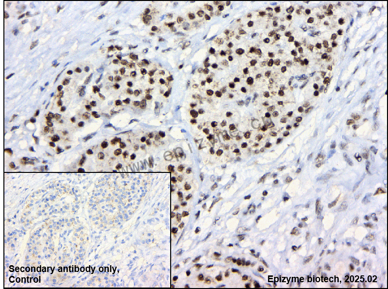 Anti-RAP1/TERF2IP Mouse mAb [87C88P28]