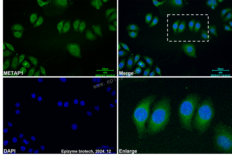 Anti-METAP1 Mouse mAb [80B09K66]