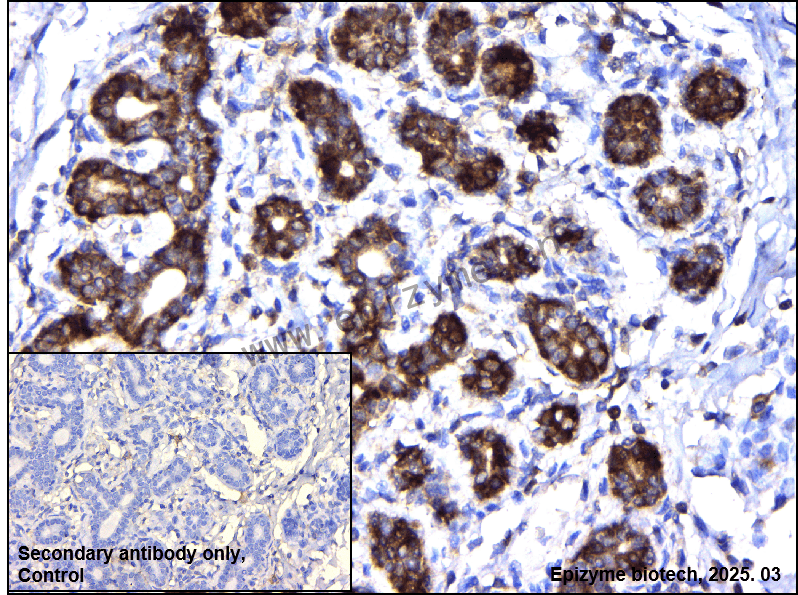 Anti-METAP1 Mouse mAb [80B09K66]