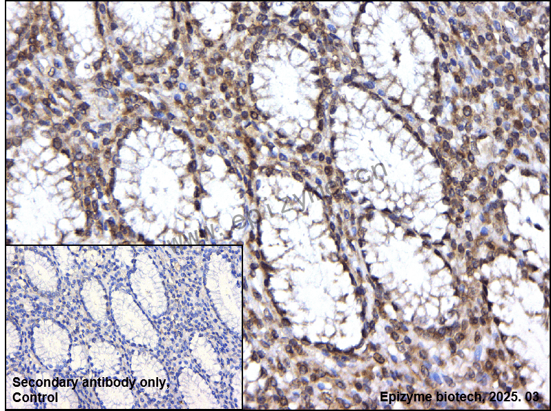 Anti-SCAP Mouse mAb [17D22K25]