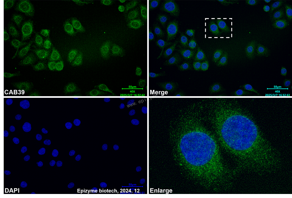 Anti-CAB39 Mouse mAb [35I61B13]
