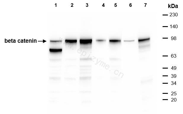 Anti-beta catenin Mouse mAb [79R45A03]