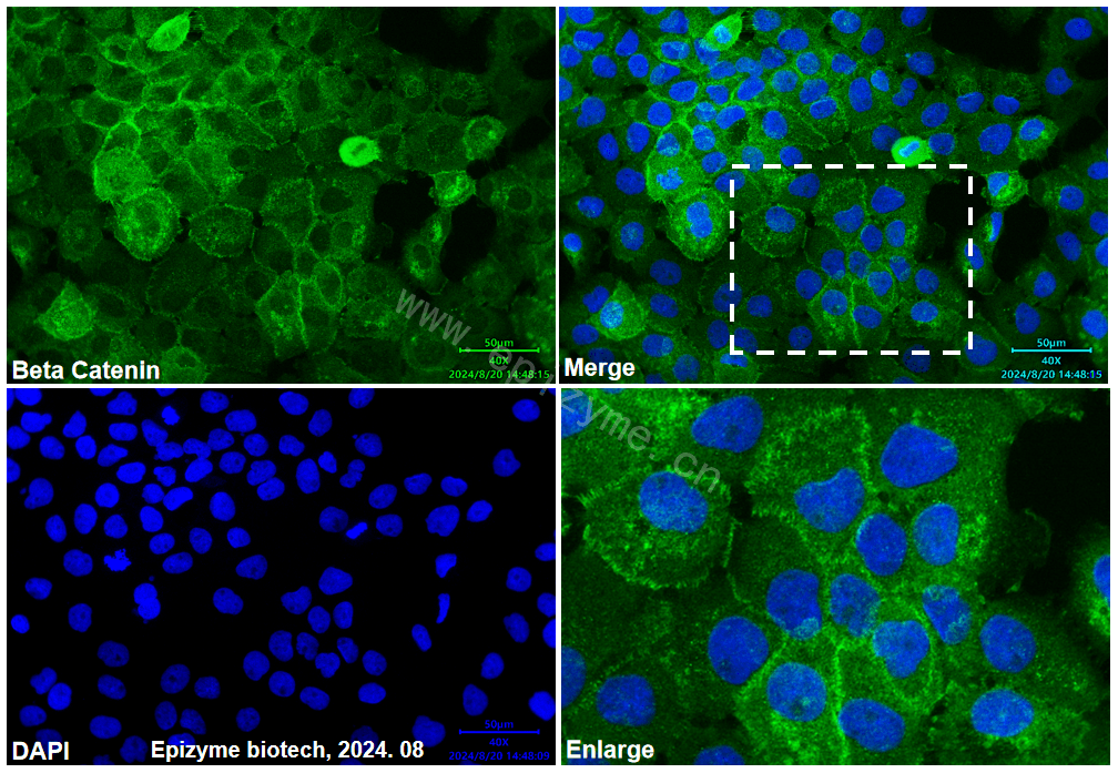 Anti-beta catenin Mouse mAb [79R45A03]