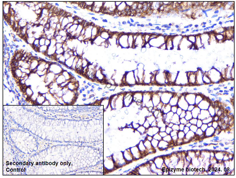 Anti-beta catenin Mouse mAb [79R45A03]
