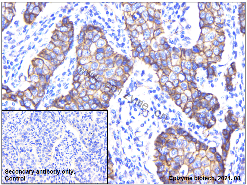 Anti-beta catenin Mouse mAb [79R45A03]