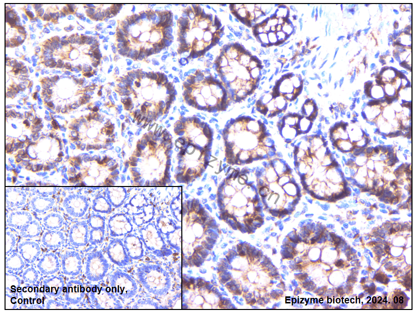 Anti-beta catenin Mouse mAb [79R45A03]