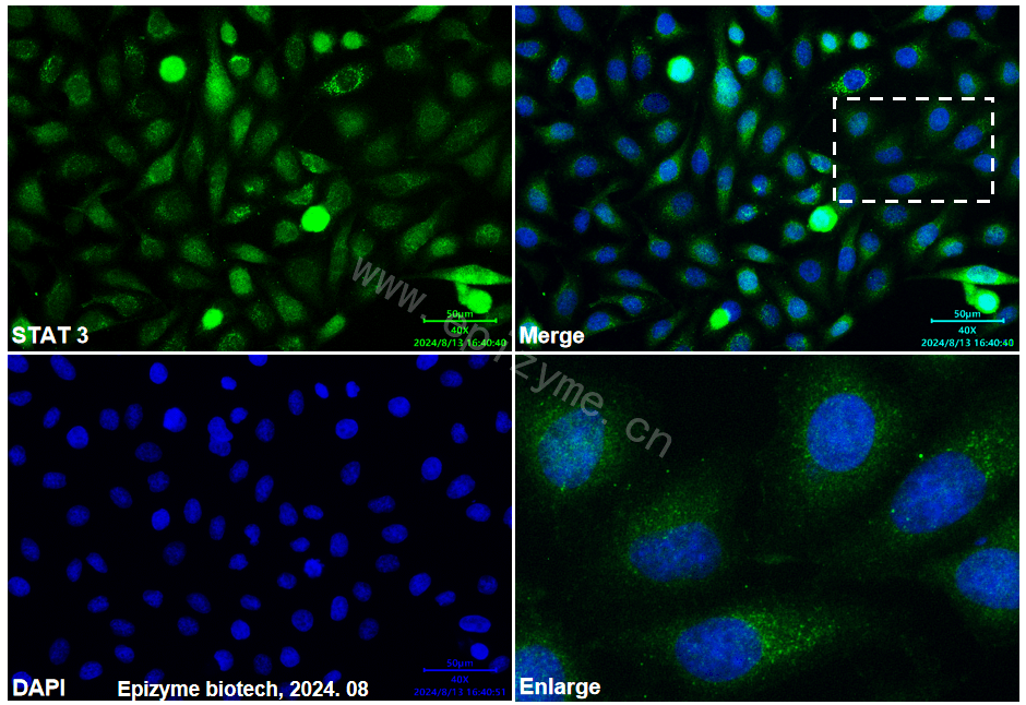 Anti-mTOR Mouse mAb [91K70Q97]