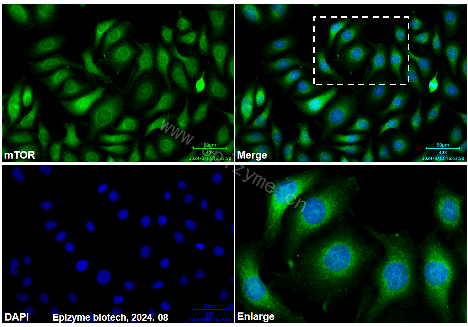 Anti-mTOR Mouse mAb [91K70Q97]
