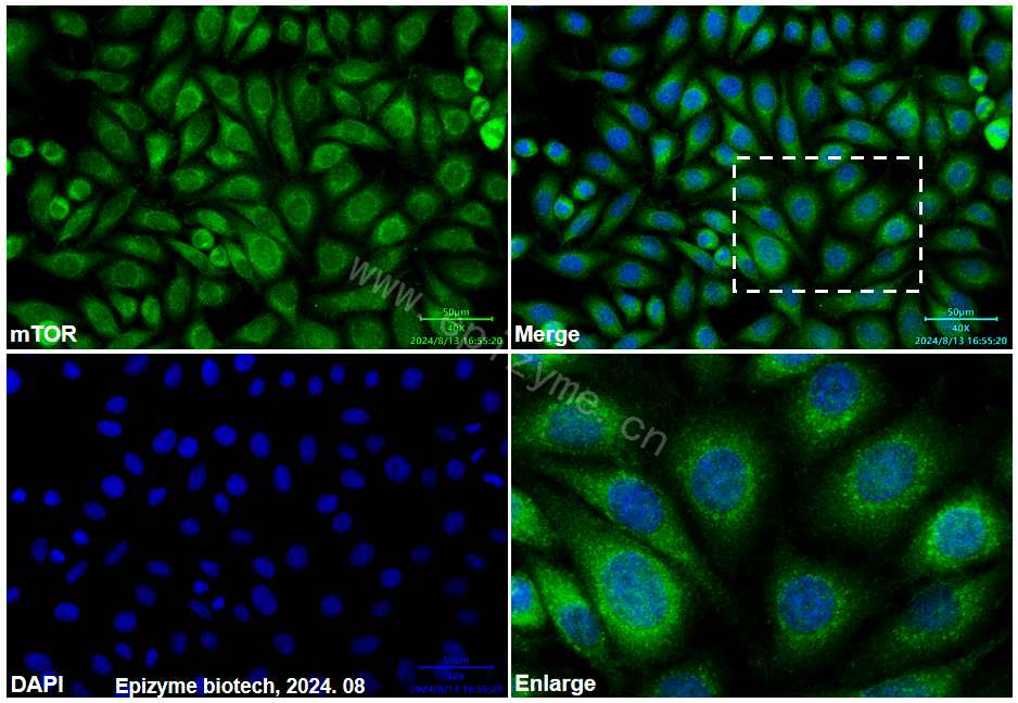 Anti-mTOR Mouse mAb [91K70Q97]