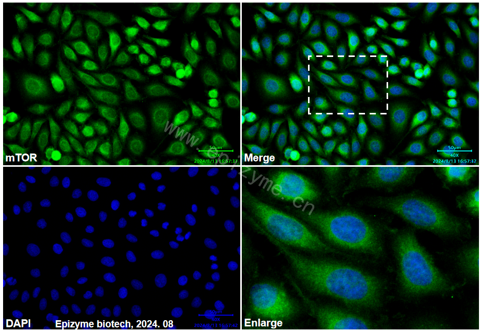Anti-mTOR Mouse mAb [91K70Q97]