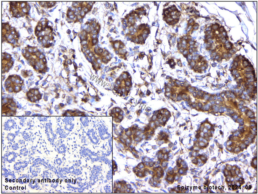 Anti-mTOR Mouse mAb [91K70Q97]