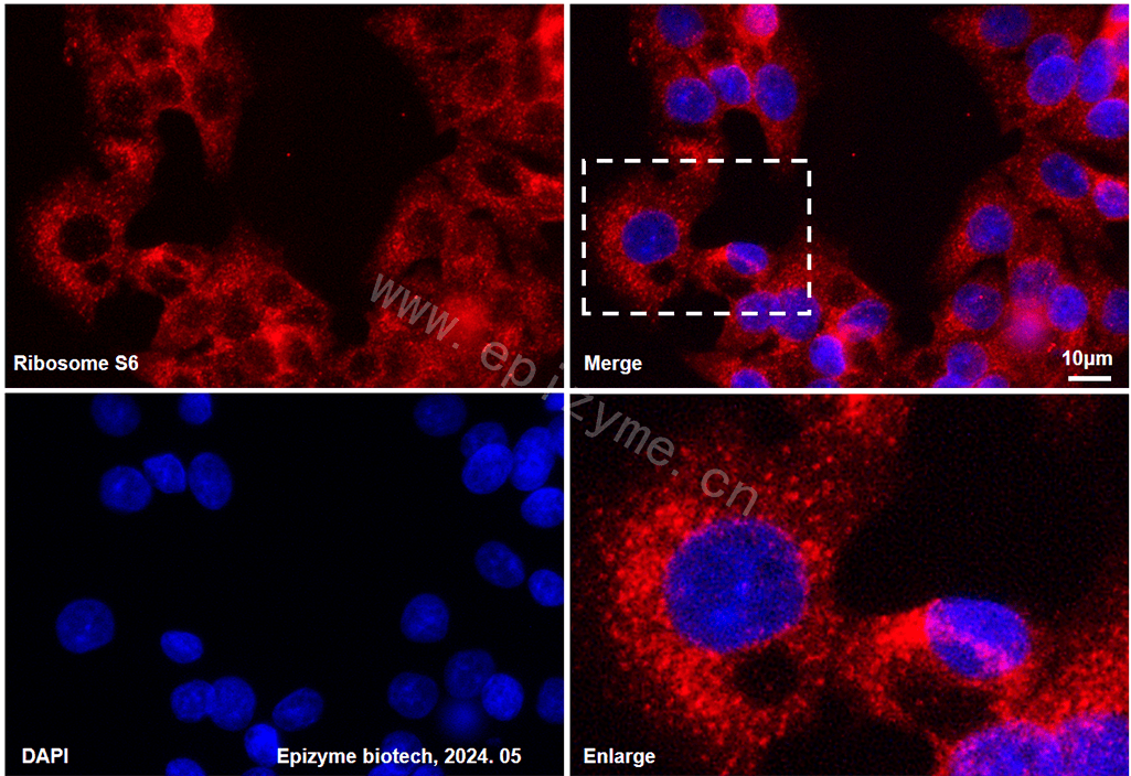 Anti-RPS6 Mouse mAb [19H63K06]