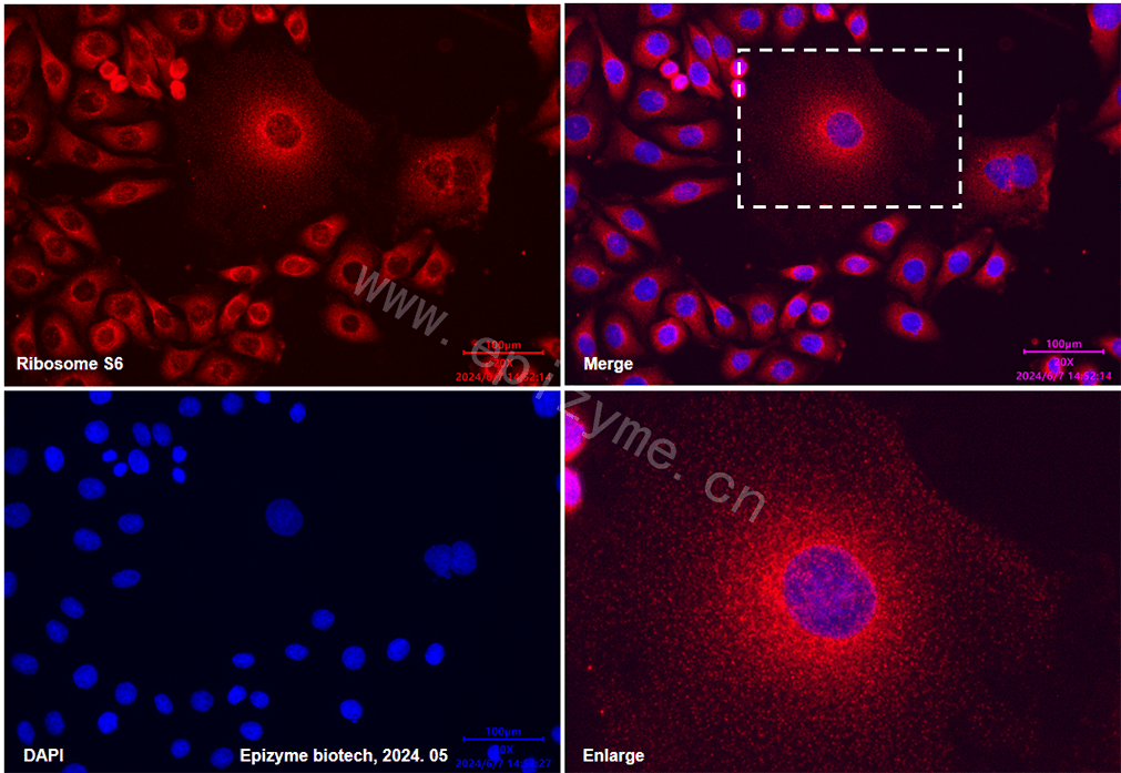 Anti-RPS6 Mouse mAb [19H63K06]