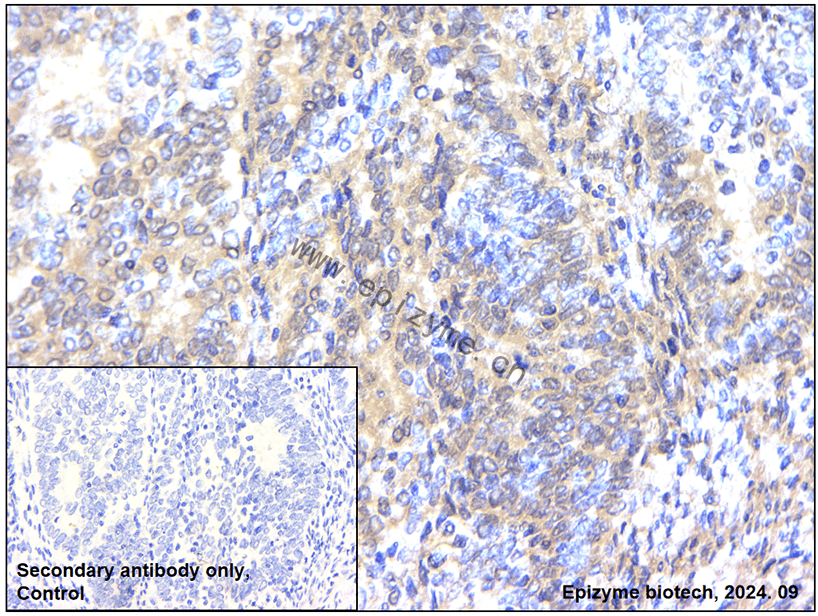 Anti-STAT3 Mouse mAb [76H67N59]