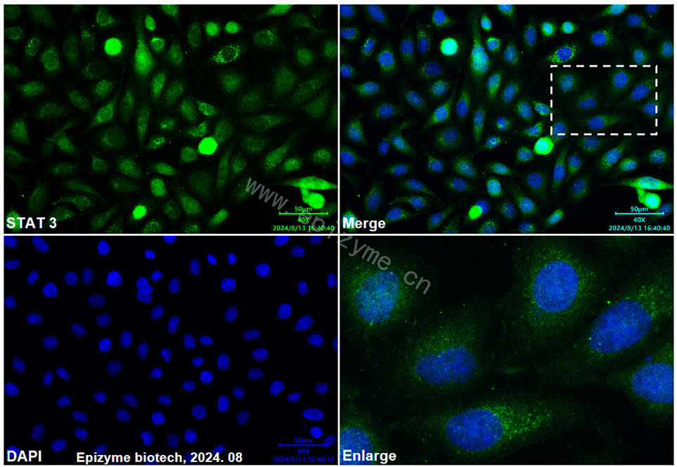 Anti-STAT3 Mouse mAb [76H67N59]