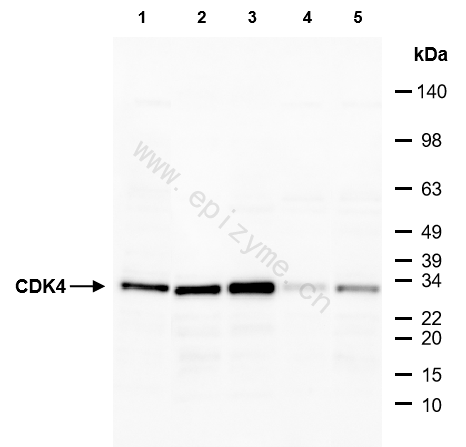 Anti-CDK4 Mouse mAb [17D20H06]