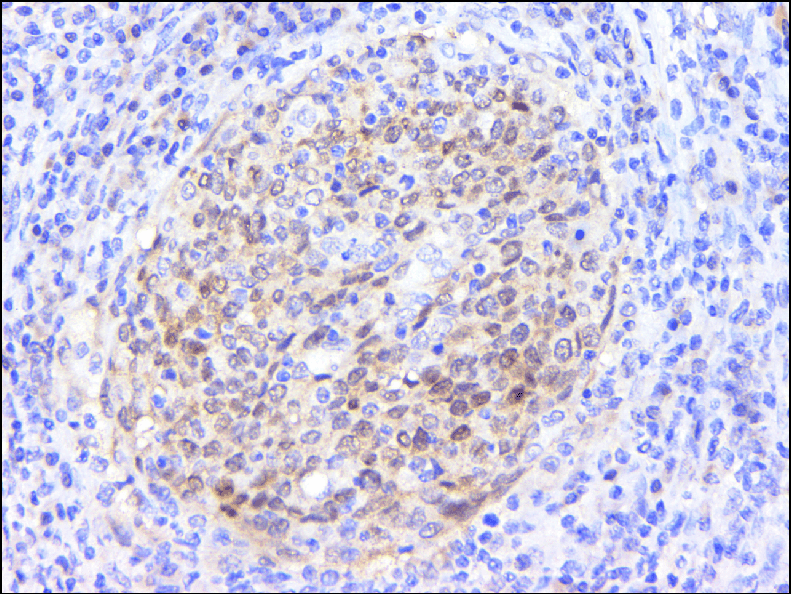 Anti-CDK4 Mouse mAb [17D20H06]
