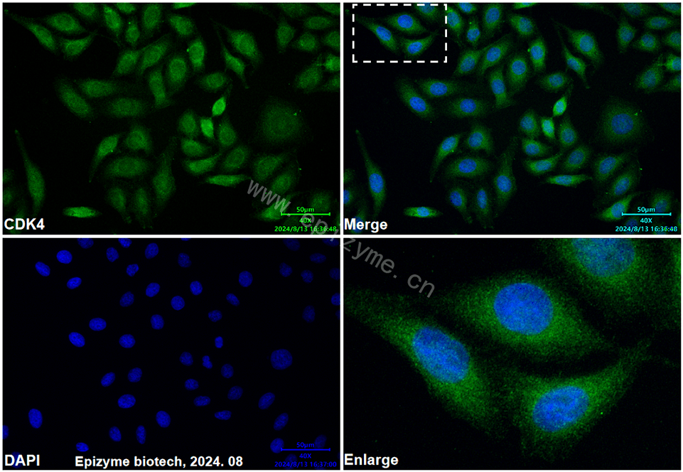 Anti-CDK4 Mouse mAb [17D20H06]