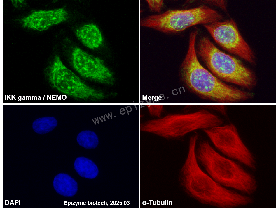 Anti-IKK gamma/NEMO Rabbit mAb [89M22M25]