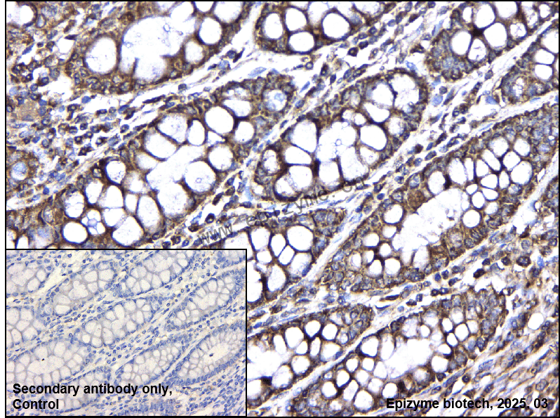 Anti-IKK gamma/NEMO Rabbit mAb [89M22M25]