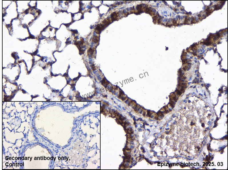 Anti-IKK gamma/NEMO Rabbit mAb [89M22M25]