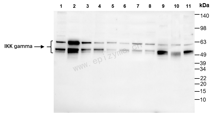 Anti-IKK gamma/NEMO Rabbit mAb [89M22M25]