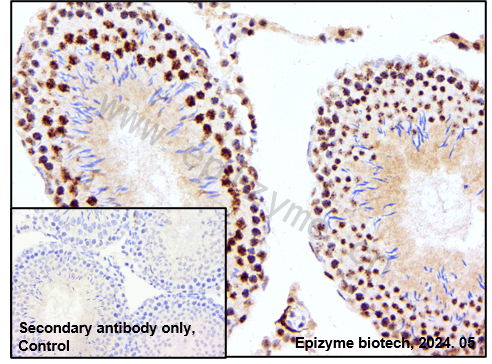 Anti-Phospho-c-Myc (Ser62) Rabbit mAb [62M57L73]