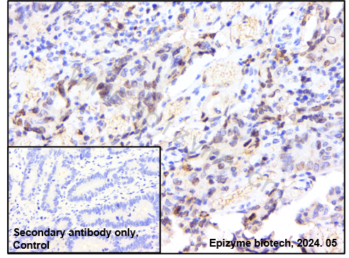 Anti-Phospho-c-Myc (Ser62) Rabbit mAb [62M57L73]