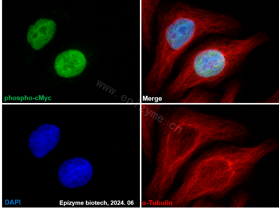 Anti-Phospho-c-Myc (Ser62) Rabbit mAb [62M57L73]