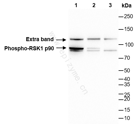 Anti-Phospho-RSK1 p90 (Thr359/Ser363) Rabbit mAb [18M71M80]