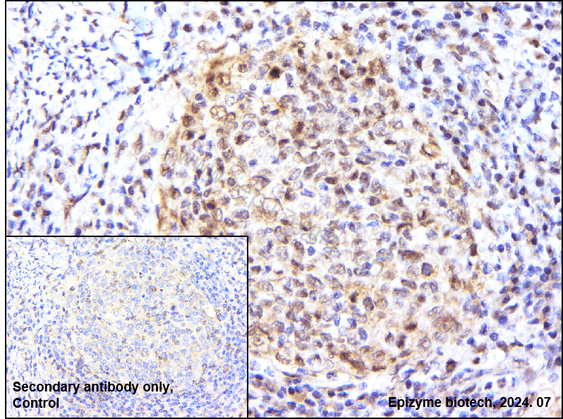 Anti-Phospho-RSK1 p90 (Thr359/Ser363) Rabbit mAb [18M71M80]