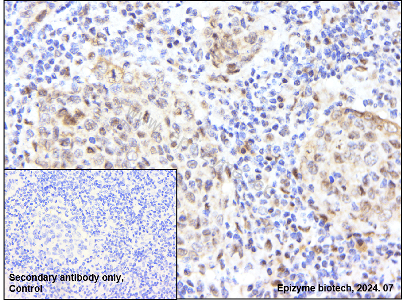 Anti-Phospho-RSK1 p90 (Thr359/Ser363) Rabbit mAb [18M71M80]