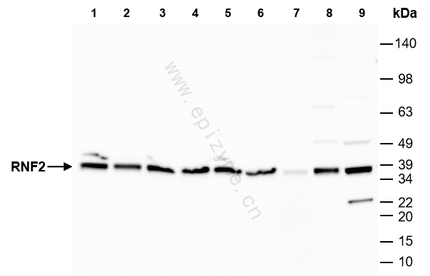 Anti-RING2/RNF2 Rabbit mAb [48K18L31]
