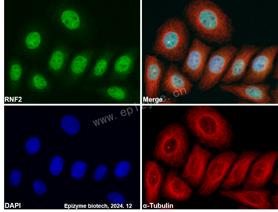 Anti-RING2/RNF2 Rabbit mAb [48K18L31]