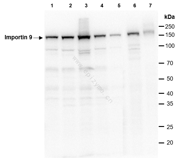 Anti-Importin 9 Rabbit mAb [38L48L23]