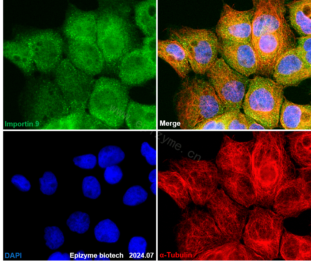 Anti-Importin 9 Rabbit mAb [38L48L23]