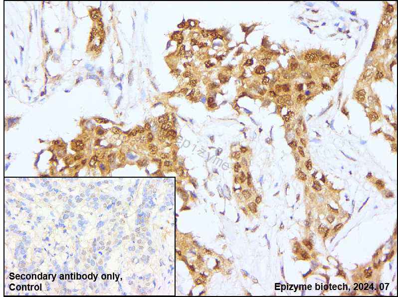 Anti-Importin 9 Rabbit mAb [38L48L23]