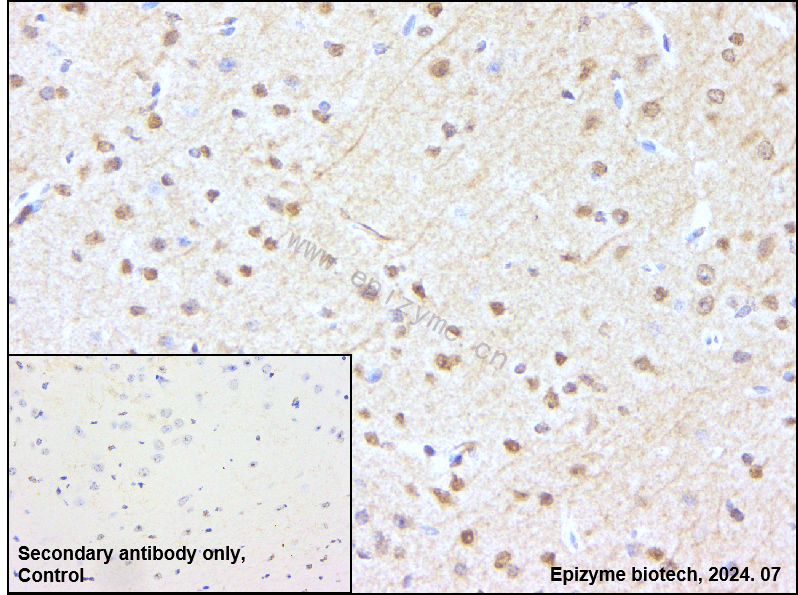 Anti-Importin 9 Rabbit mAb [38L48L23]