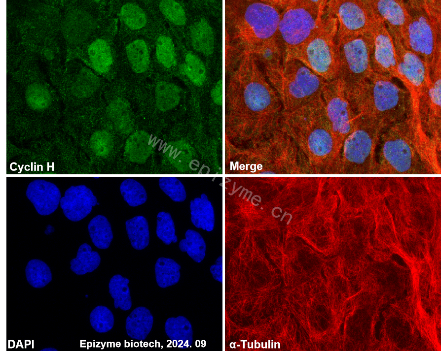 Anti-Cyclin H Rabbit mAb [54K64M43]