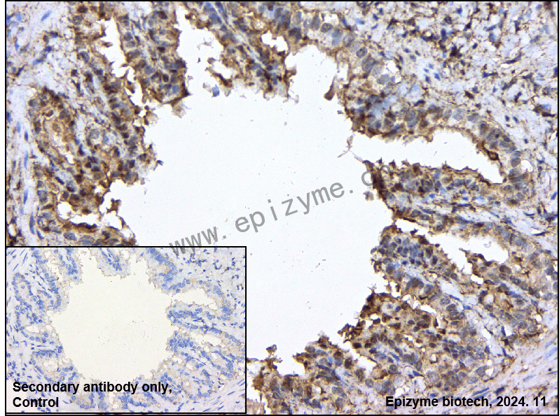 Anti-LRP1 Rabbit mAb [19M71K09]
