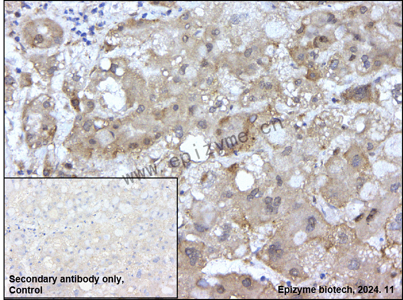 Anti-LRP1 Rabbit mAb [19M71K09]