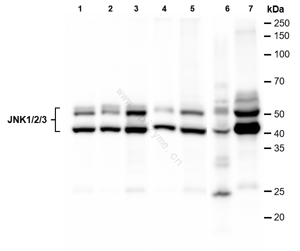 Anti-JNK1/2/3 Rabbit mAb [62M83L63]