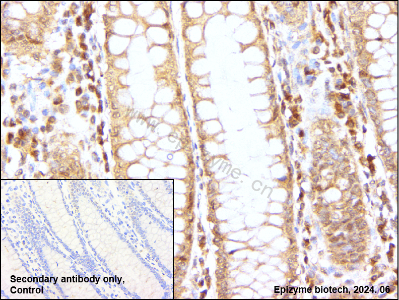 Anti-JNK1/2/3 Rabbit mAb [62M83L63]